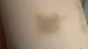 Moguće je da vaše tijelo šalje ozbiljan signal/Pinterest