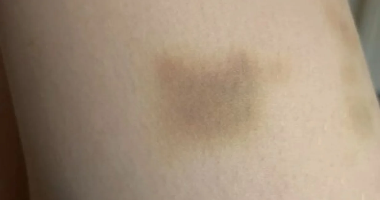 Moguće je da vaše tijelo šalje ozbiljan signal/Pinterest