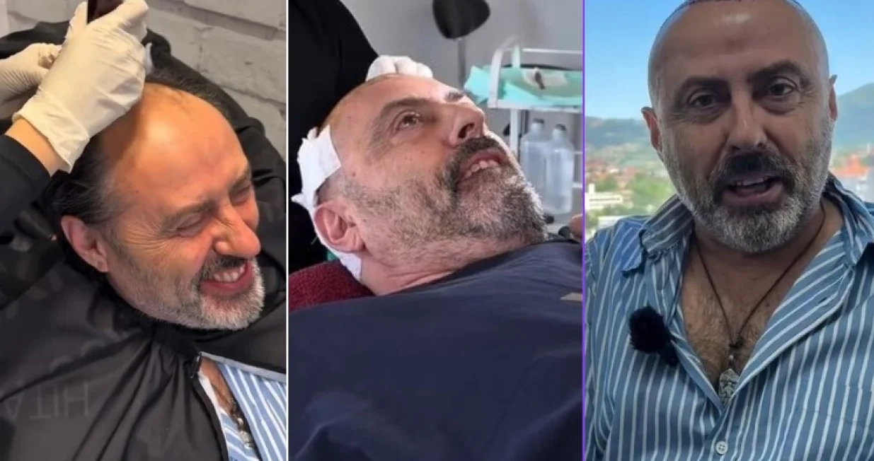 Sejo Sexon za vrijeme i nakon operacije/