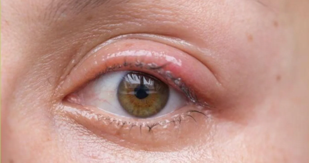 Svi ga imate kod kuće/Pinterest