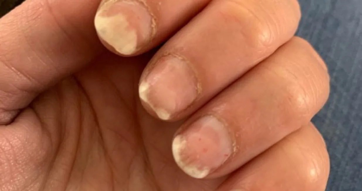 Tijelo šalje važnu poruku/Pinterest