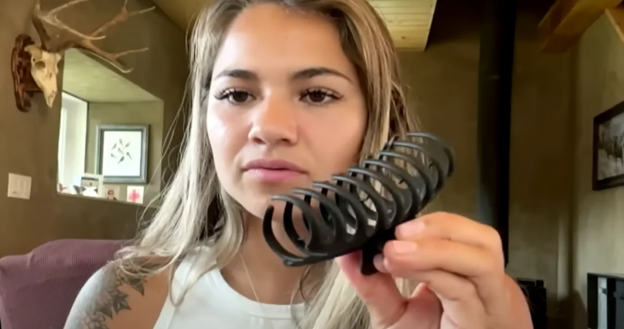 Kanađanku napao medvjed, preživjela je s 30 šavova. "Spasila me kopča za kosu"/Screenshot