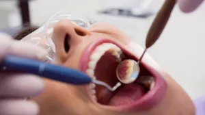 Oprezno s priborom i poljupcima/Free Pik