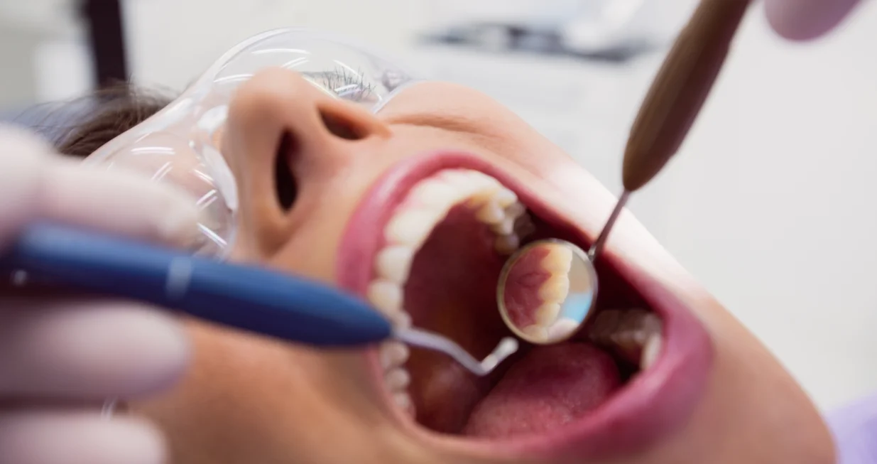 Oprezno s priborom i poljupcima/Free Pik