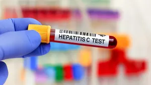 Test na hepatitis C//