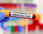 Test na hepatitis C//