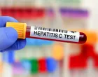 Test na hepatitis C//