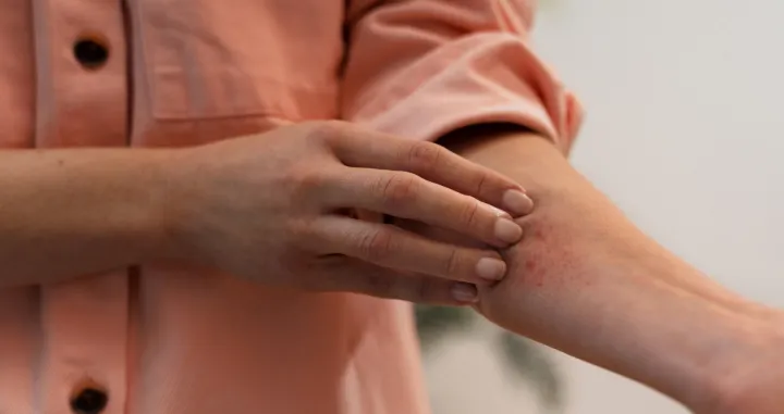 Zaštite kožu/Freepik