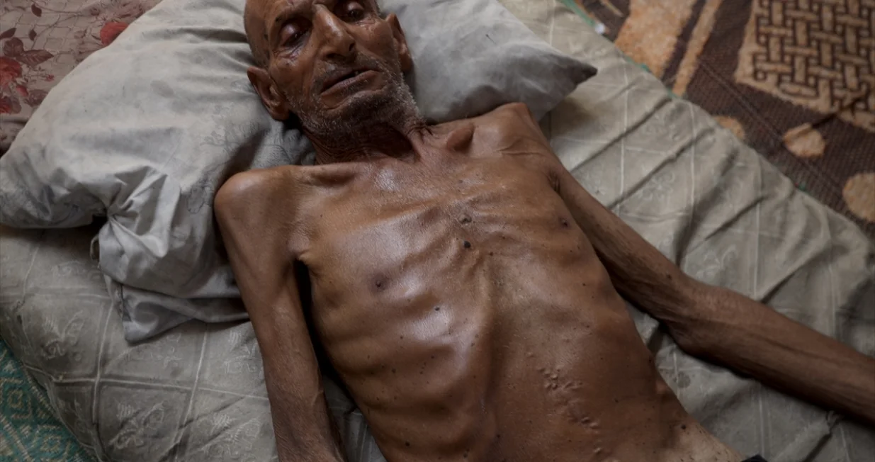 Selim Asfur bori se da preživi/Anadolija/