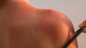 Zadrži sjaj ljeta na koži/Freepik