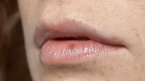 Pravovremena reakcija je ključna/Free Pik