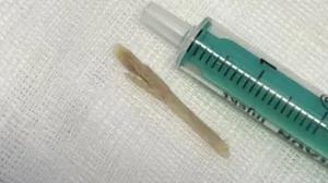 Kost koja je zapela u grlu djevojčice/