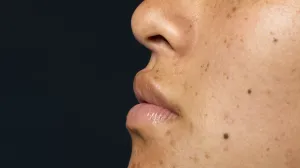 Iznenađujuće rješenje iz kuhinje/Free Pik