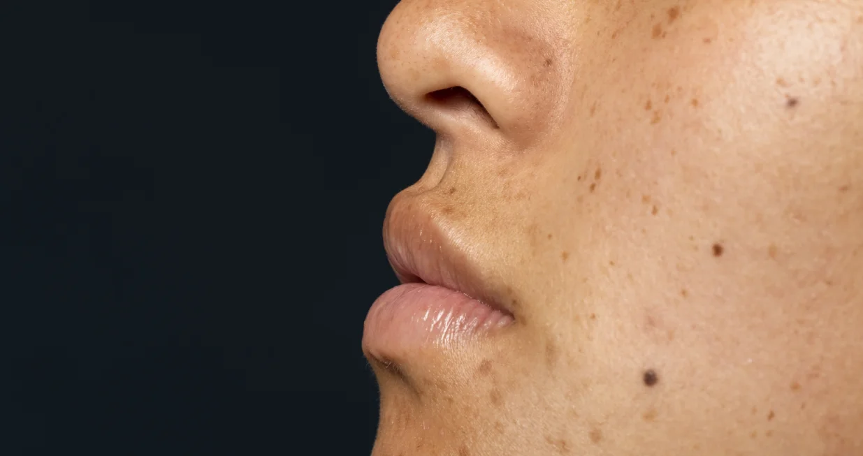 Iznenađujuće rješenje iz kuhinje/Free Pik