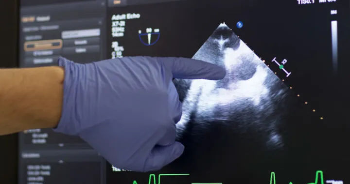 Brojne srčane nepravilnosti/Ilustracija/