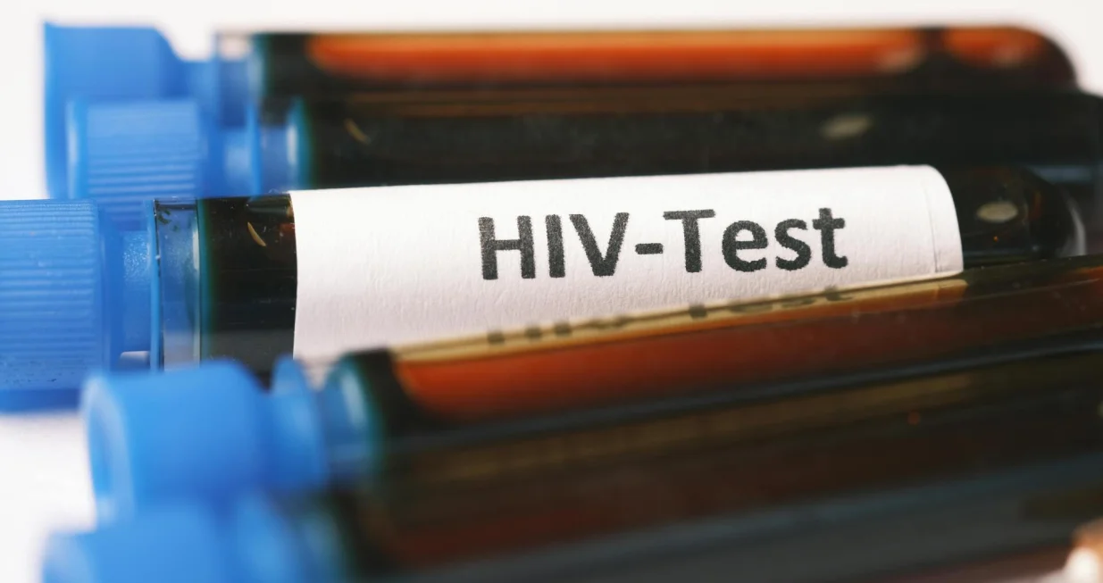 Test na HIV/Towfiqu Barbhuiya