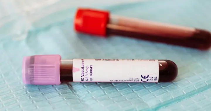 Ilustracija/ Pexels/