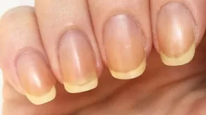 Stručnjaci odgovorili/Pinterest