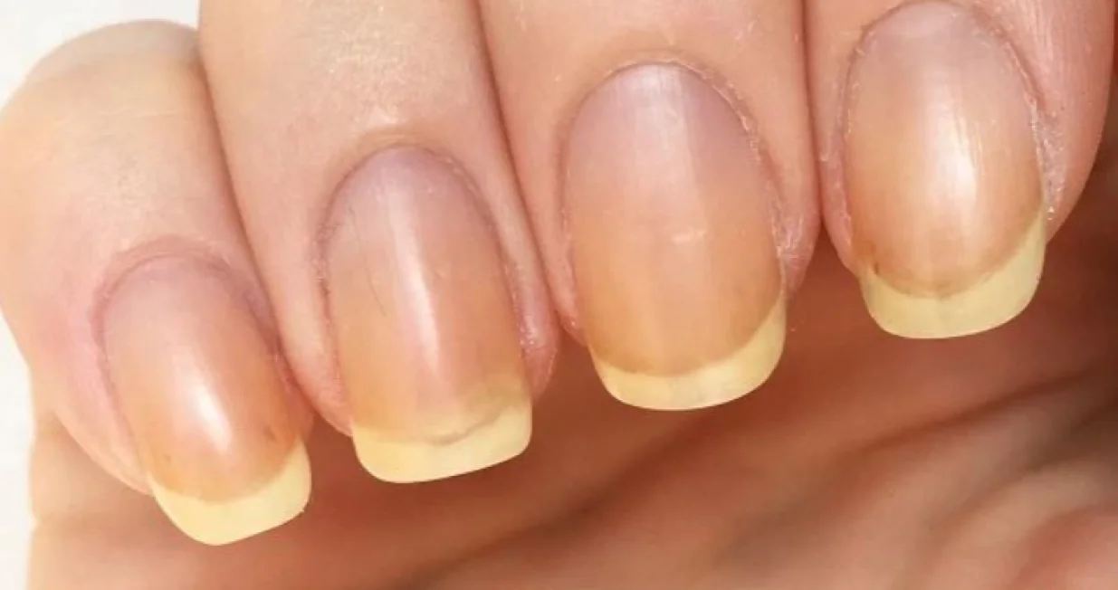 Stručnjaci odgovorili/Pinterest