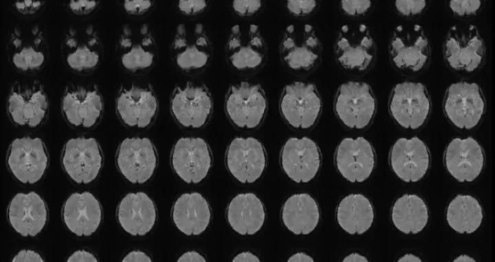 AI je naučila da povezuje obrasce moždane aktivnosti/