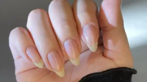 Spriječite pucanje na vrijeme/Pinterest