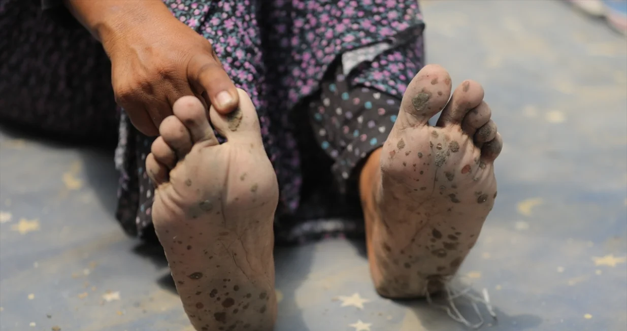 Djeca u Gazi hodaju bosa/Anadolija/