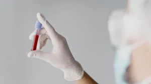 Tajna dugovječnosti krije se u laboratorijskom nalazu/Free Pik