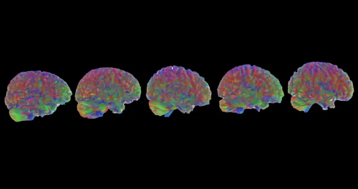 Pet moždanih doba: djetinjstvo, adolescencija, odrasla dob, rano starenje i kasno starenje.Zasluge za sliku: Dr. Alexa Mousley, Univerzitet u Cambridgeu; modificirano od strane IFLScience/