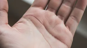 Imate li je vi?/Ilustracija