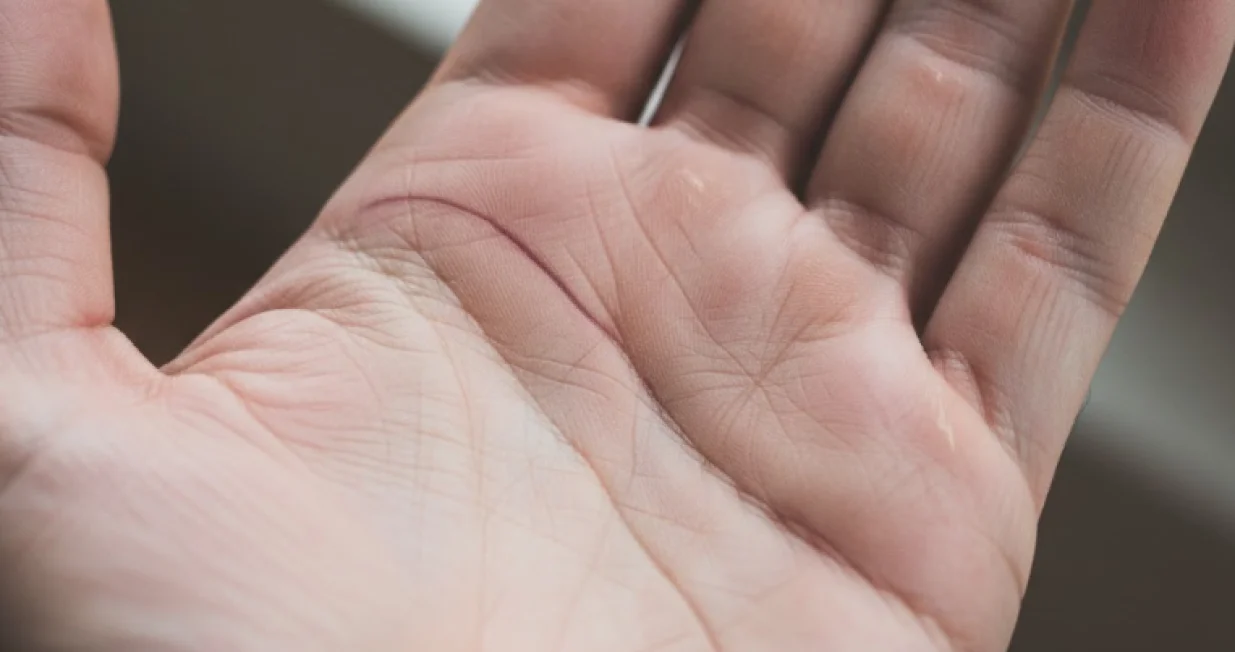 Imate li je vi?/Ilustracija