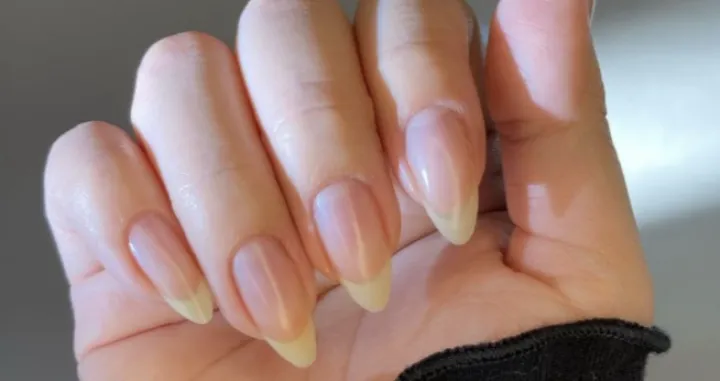 Spriječite pucanje na vrijeme/Pinterest