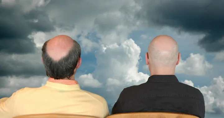 Genetika je najče&scaron;ći uzrok ćelavosti/ Ilustracija/