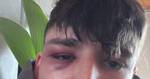 Pascal Kaiser (FOTO: X)/Foto: 