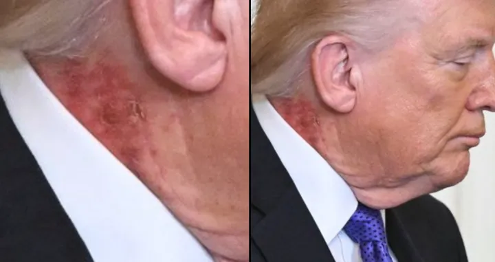 donald trump, vrat,krasta, rana/Screenshot