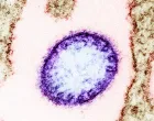 Virus Nipah/Ilustracija/Wikimedia/